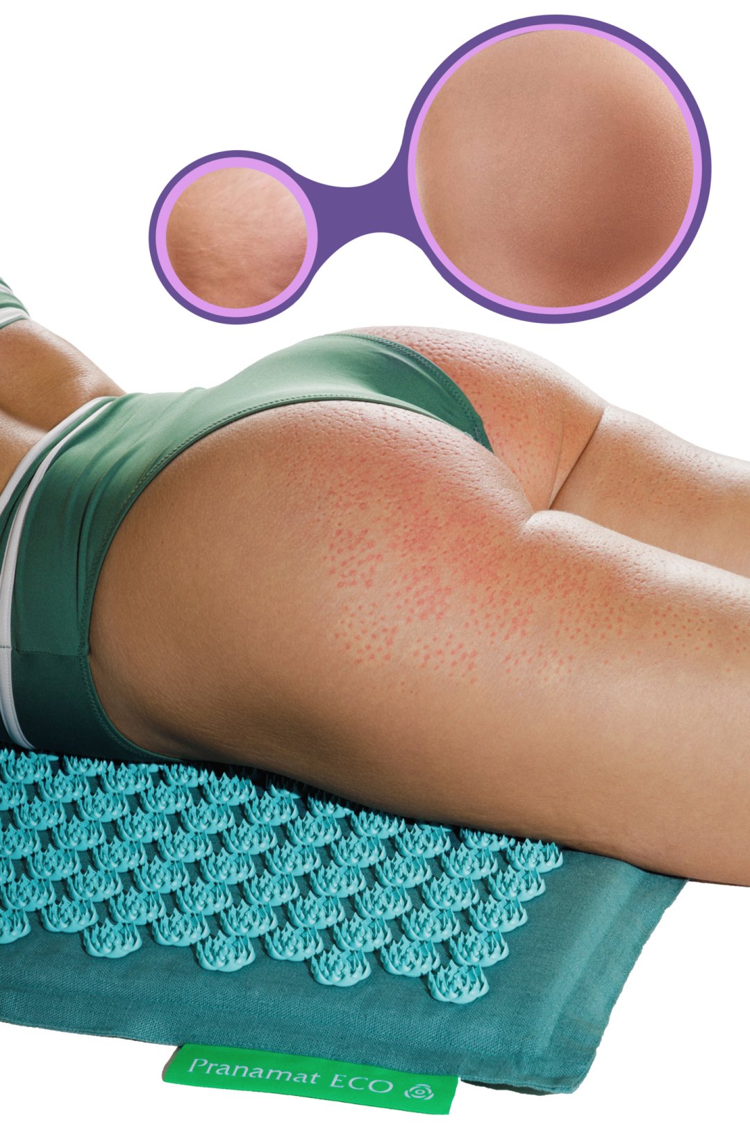 Increase the circulation to the problem area and reduce the cellulite