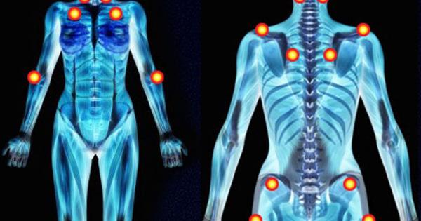 Fibromyalgia: how to live with this condition?
